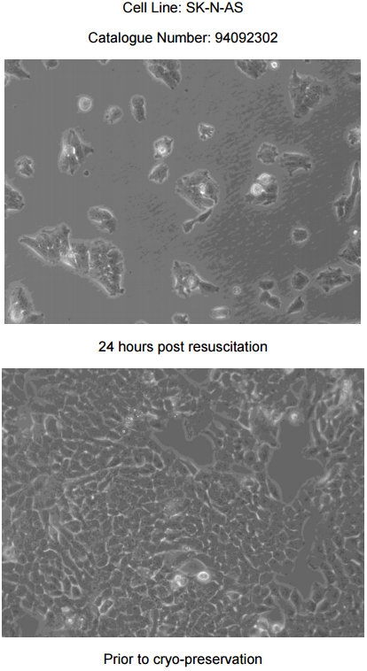 SK-N-AS细胞图片