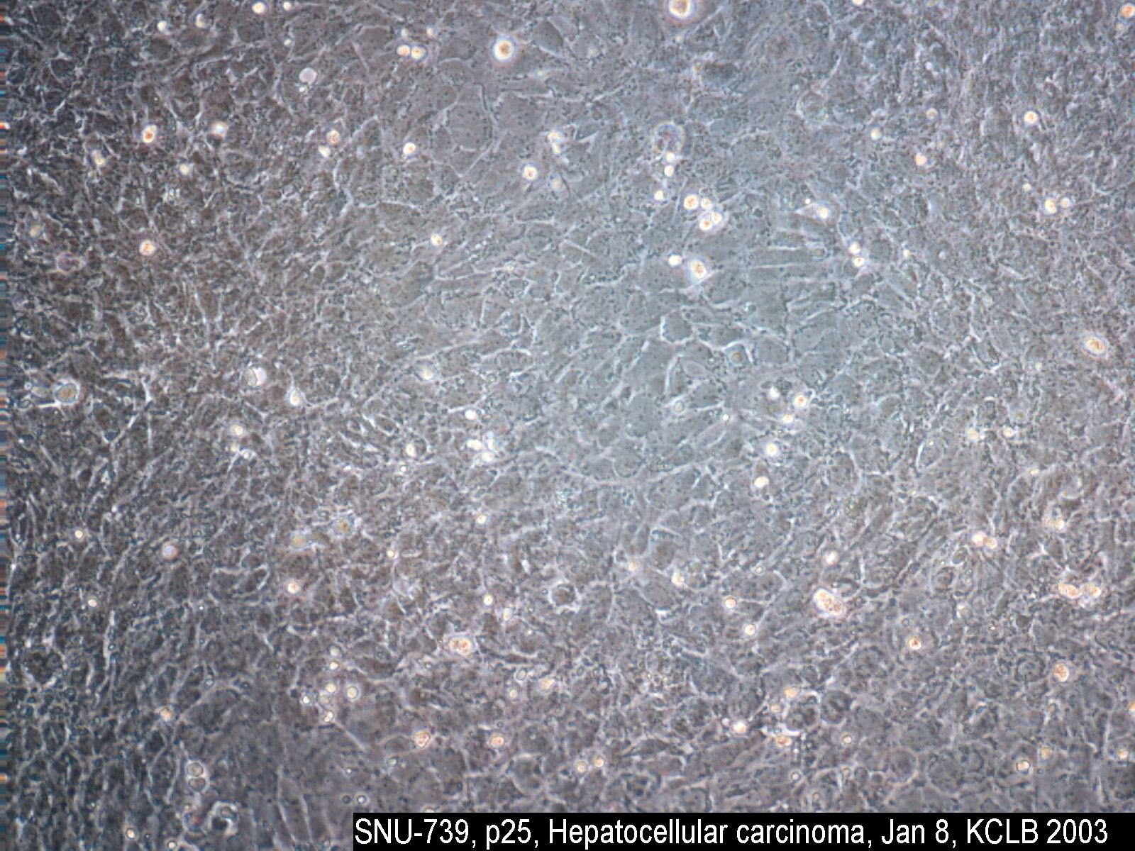 ATCC CCL-228 SNU-739细胞图片