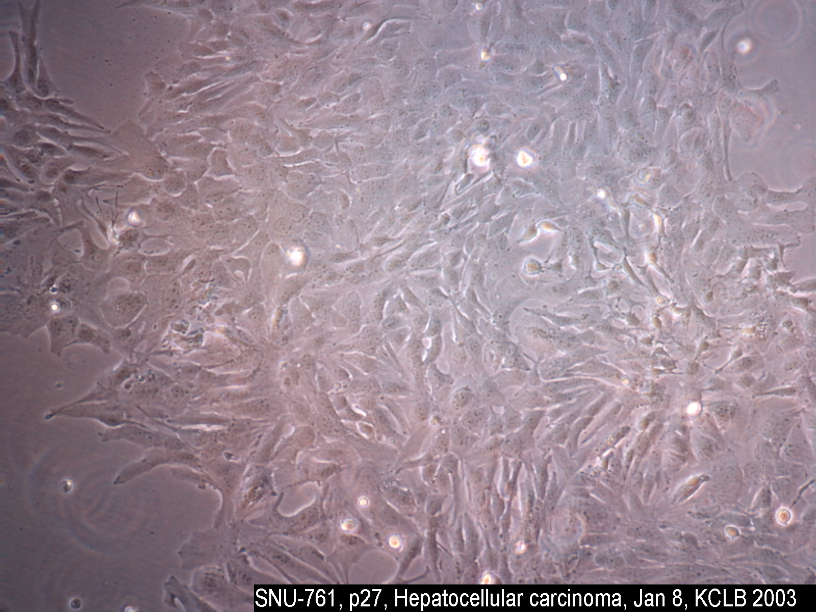 SNU-761细胞图片