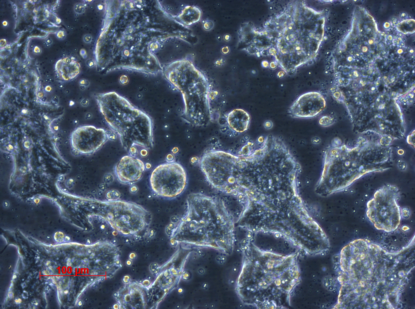 SW403细胞图片