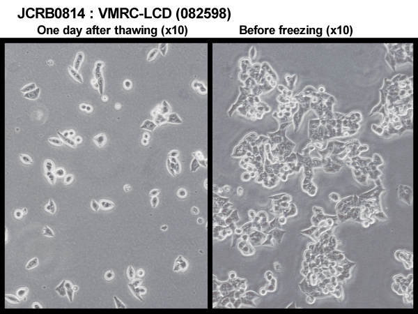 VMRC-LCD细胞图片
