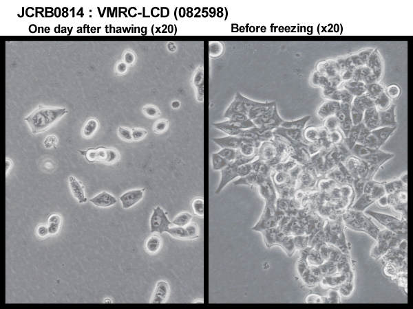 VMRC-LCD细胞图片
