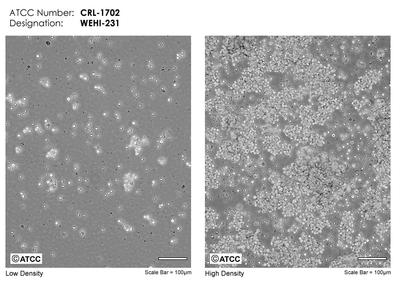 WEHI-231细胞图片