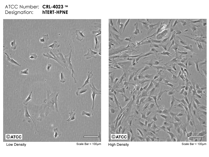hTERT-HPNE细胞图片